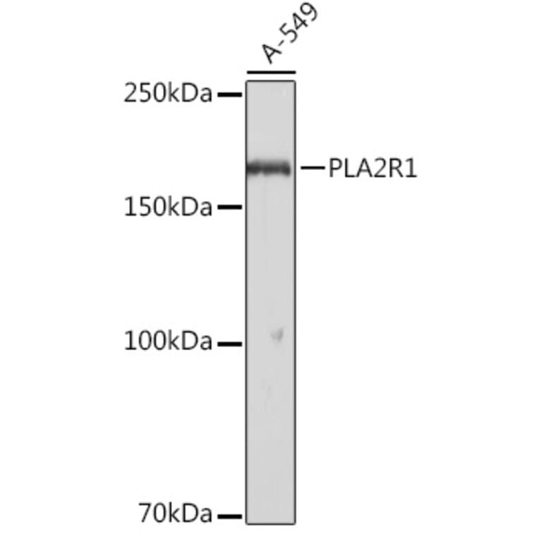 Western Blot - Anti-PLA2R Antibody (A11232) - Antibodies.com