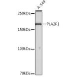 Western Blot - Anti-PLA2R Antibody (A11232) - Antibodies.com