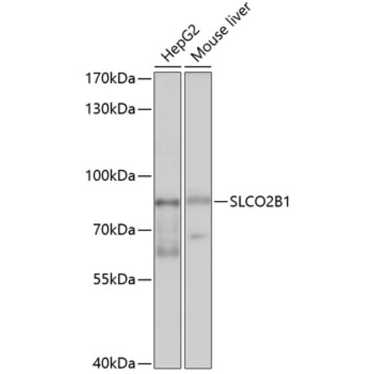 Western Blot - Anti-SLCO2B1/OATP2B1 Antibody (A11233) - Antibodies.com