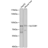 Western Blot - Anti-SLCO2B1/OATP2B1 Antibody (A11233) - Antibodies.com