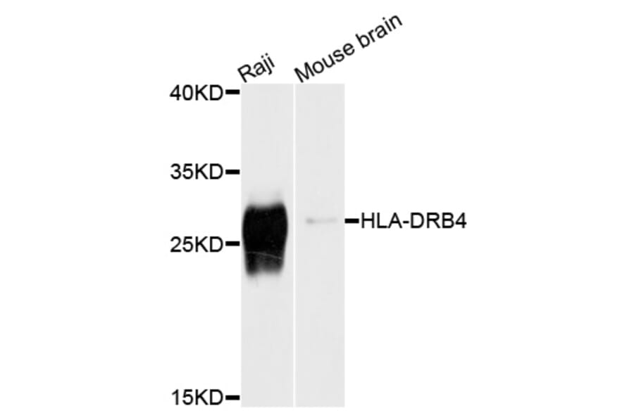 Western Blot - Anti-HLA-DRB4 Antibody (A10078) - Antibodies.com