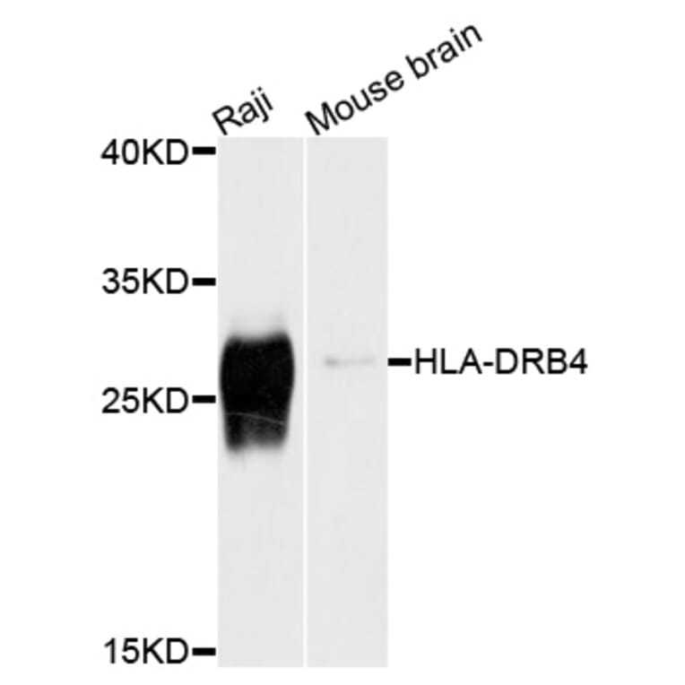Western Blot - Anti-HLA-DRB4 Antibody (A10078) - Antibodies.com