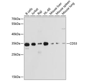 Western Blot - Anti-CD53 Antibody (A11235) - Antibodies.com
