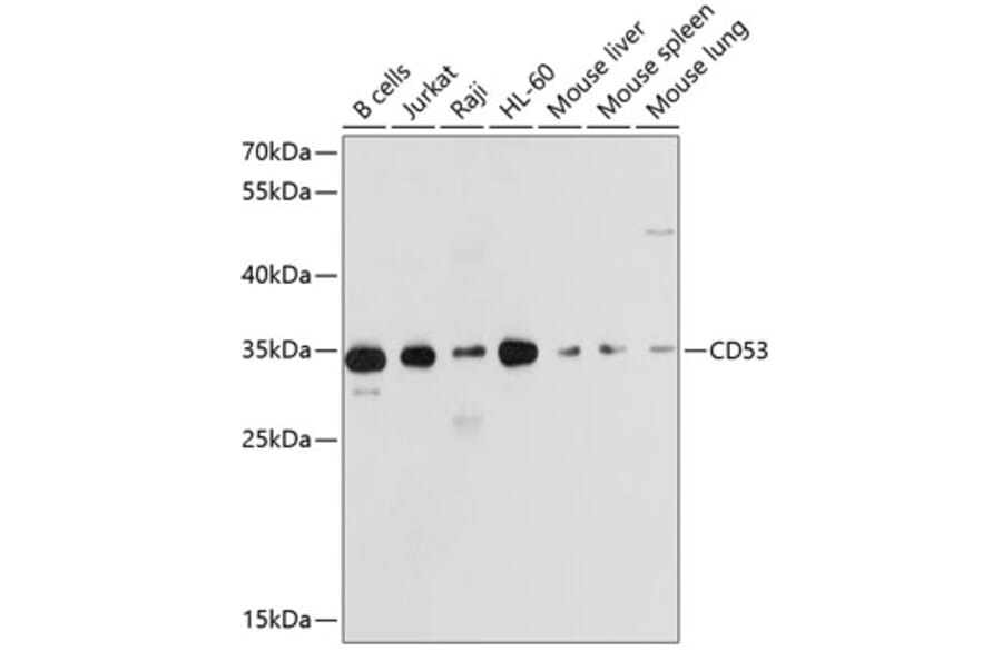 Western Blot - Anti-CD53 Antibody (A11235) - Antibodies.com