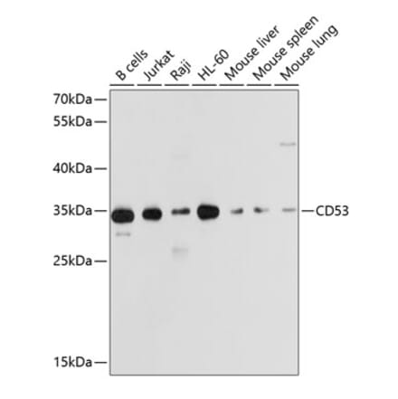 Western Blot - Anti-CD53 Antibody (A11235) - Antibodies.com