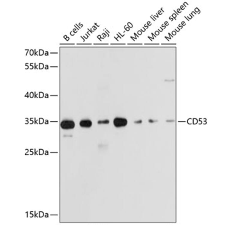 Western Blot - Anti-CD53 Antibody (A11235) - Antibodies.com