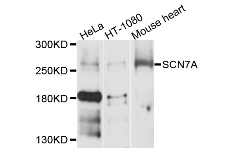 Western Blot - Anti-SCN7A Antibody (A10088) - Antibodies.com