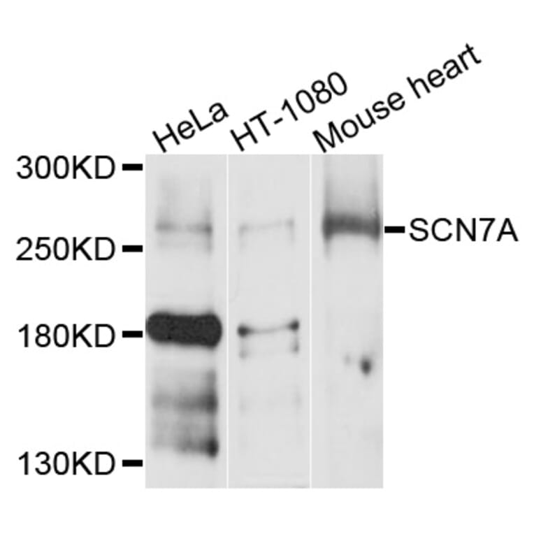 Western Blot - Anti-SCN7A Antibody (A10088) - Antibodies.com