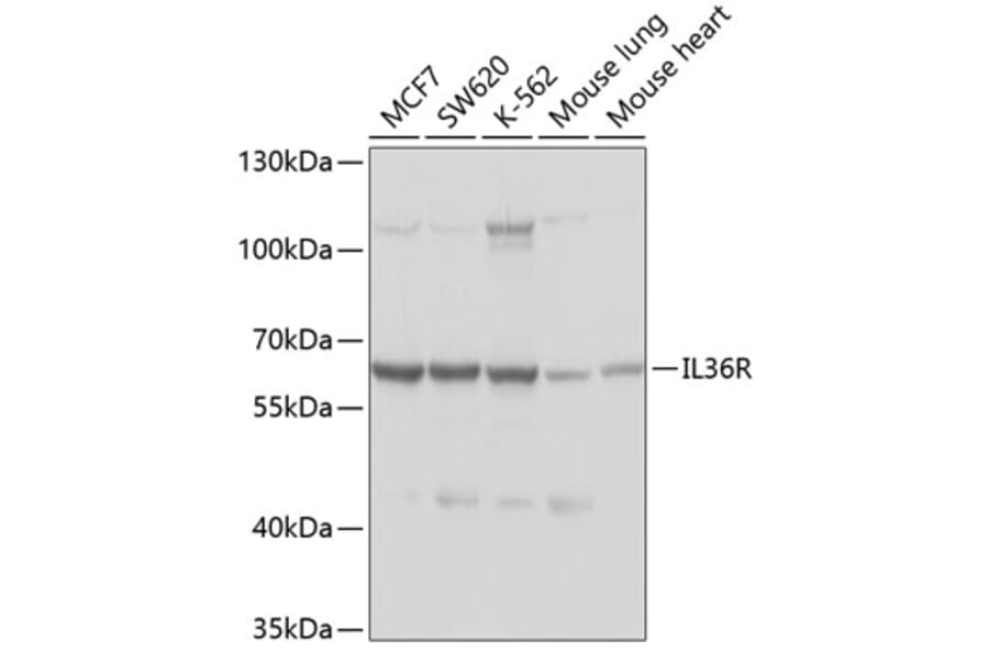 Western Blot - Anti-IL-36R Antibody (A11237) - Antibodies.com