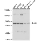 Western Blot - Anti-IL-36R Antibody (A11237) - Antibodies.com
