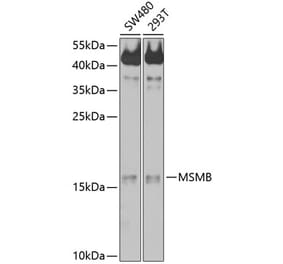 Western Blot - Anti-Prostate Secretory Protein/PSP Antibody (A11238) - Antibodies.com