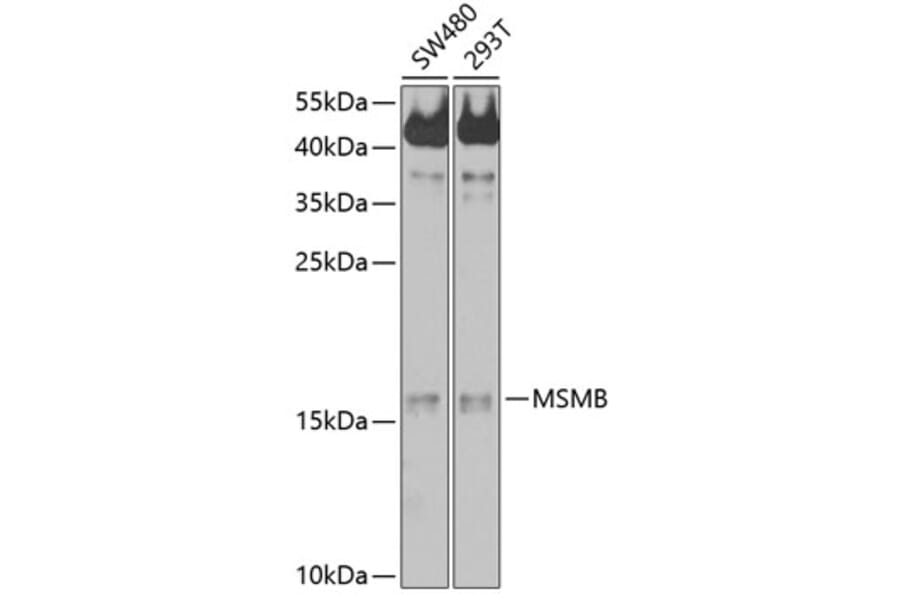 Western Blot - Anti-Prostate Secretory Protein/PSP Antibody (A11238) - Antibodies.com