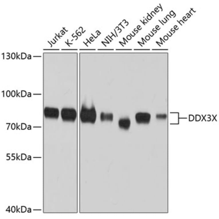 Western Blot - Anti-DDX3X Antibody (A10099) - Antibodies.com