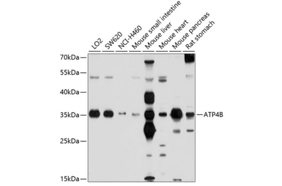 Western Blot - Anti-Hydrogen Potassium ATPase Beta/ATP4B Antibody (A11241) - Antibodies.com