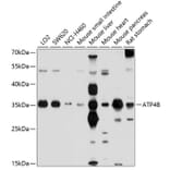 Western Blot - Anti-Hydrogen Potassium ATPase Beta/ATP4B Antibody (A11241) - Antibodies.com