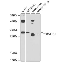 Western Blot - Anti-SLC31A1 / CTR1 Antibody (A11242) - Antibodies.com