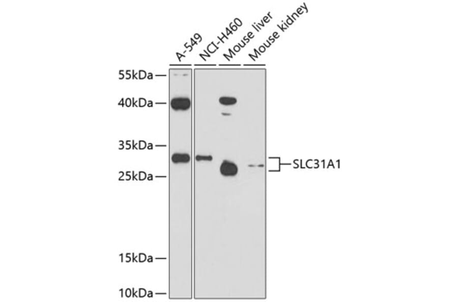 Western Blot - Anti-SLC31A1/CTR1 Antibody (A11242) - Antibodies.com