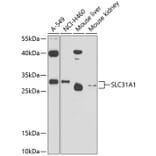 Western Blot - Anti-SLC31A1/CTR1 Antibody (A11242) - Antibodies.com