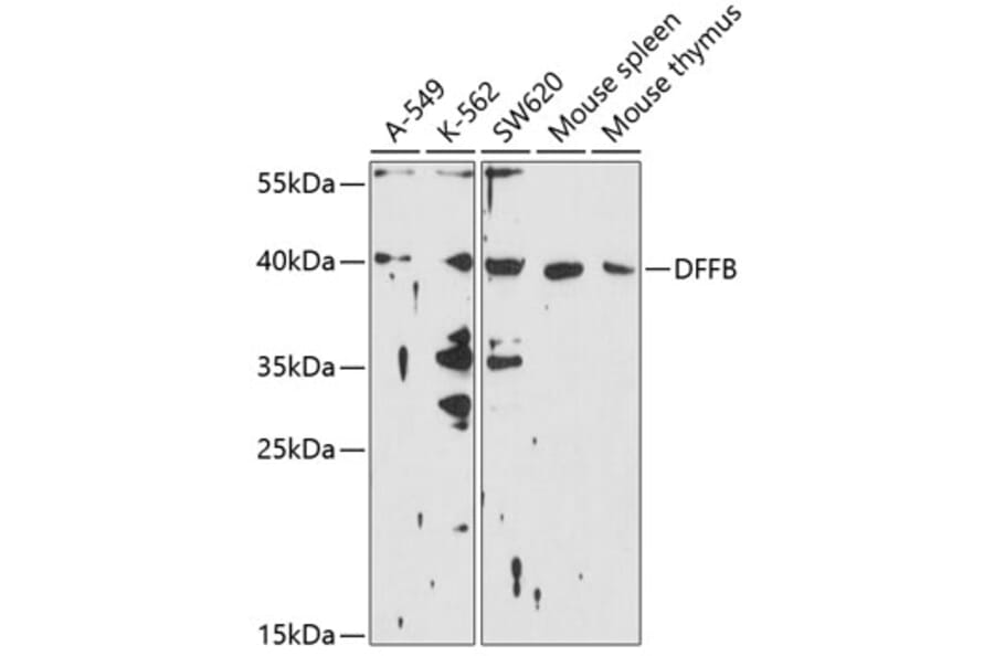Western Blot - Anti-DFFB/CAD Antibody (A11243) - Antibodies.com