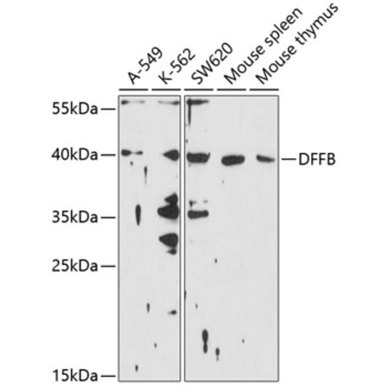 Western Blot - Anti-DFFB/CAD Antibody (A11243) - Antibodies.com