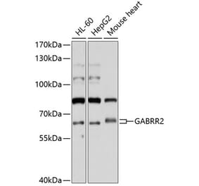 Western Blot - Anti-GABRR2 Antibody (A11244) - Antibodies.com