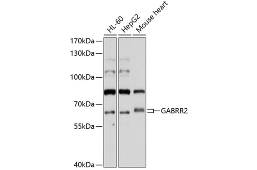 Western Blot - Anti-GABRR2 Antibody (A11244) - Antibodies.com