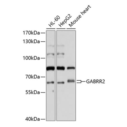 Western Blot - Anti-GABRR2 Antibody (A11244) - Antibodies.com