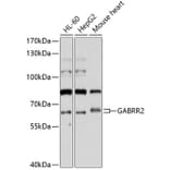 Western Blot - Anti-GABRR2 Antibody (A11244) - Antibodies.com