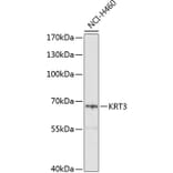 Western Blot - Anti-Cytokeratin 3/CK-3 Antibody (A11245) - Antibodies.com