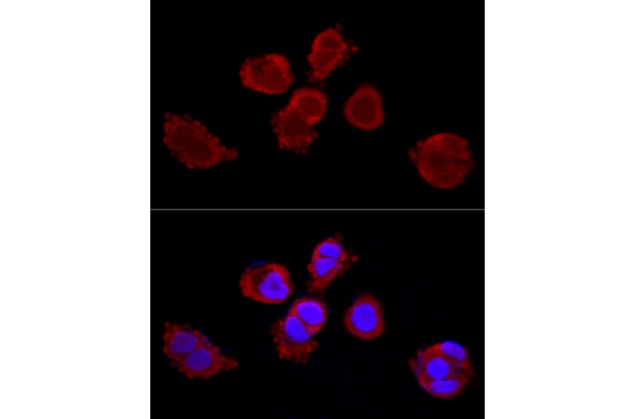 Immunofluorescence - Anti-Cytokeratin 3/CK-3 Antibody (A11245) - Antibodies.com