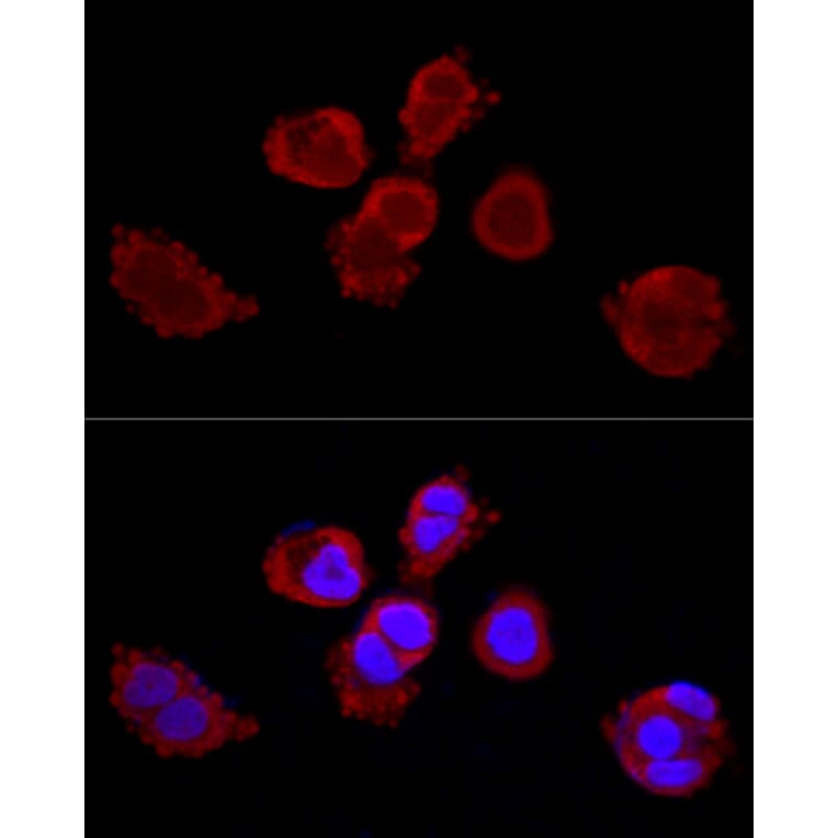 Immunofluorescence - Anti-Cytokeratin 3/CK-3 Antibody (A11245) - Antibodies.com