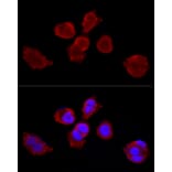 Immunofluorescence - Anti-Cytokeratin 3/CK-3 Antibody (A11245) - Antibodies.com