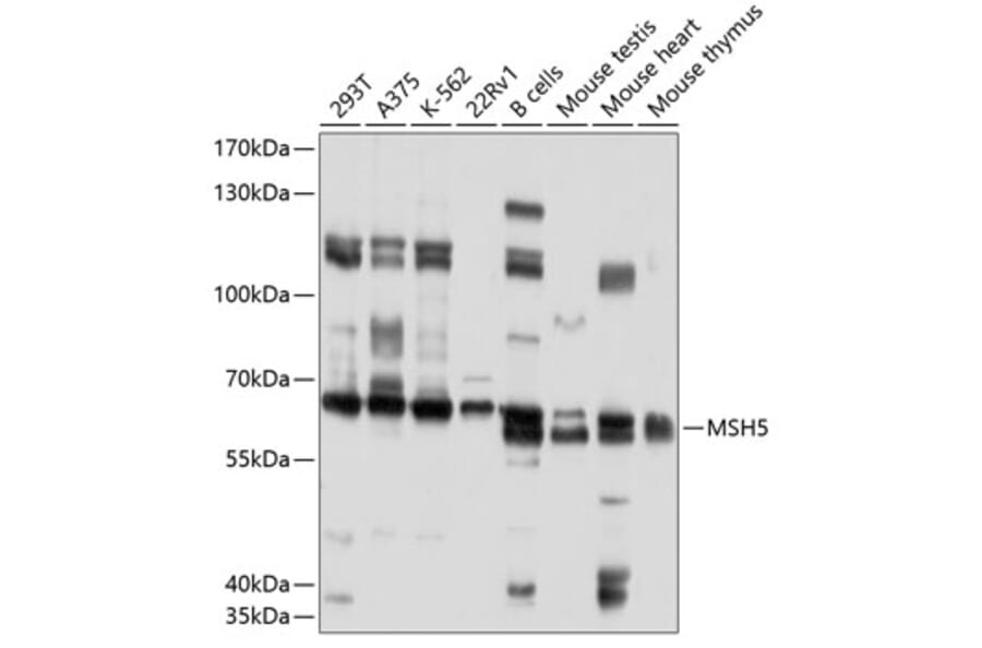 Western Blot - Anti-MSH5 Antibody (A10121) - Antibodies.com