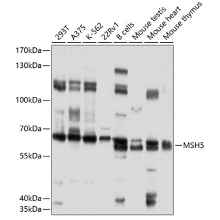 Western Blot - Anti-MSH5 Antibody (A10121) - Antibodies.com