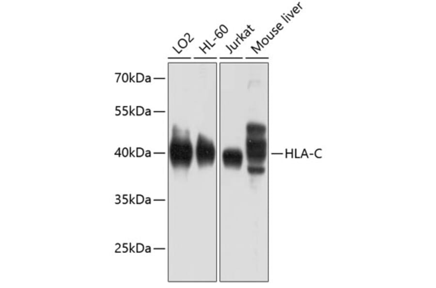 Western Blot - Anti-HLA-C Antibody (A11247) - Antibodies.com