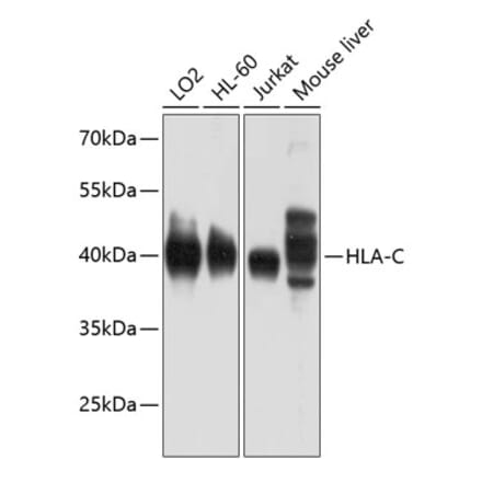 Western Blot - Anti-HLA-C Antibody (A11247) - Antibodies.com