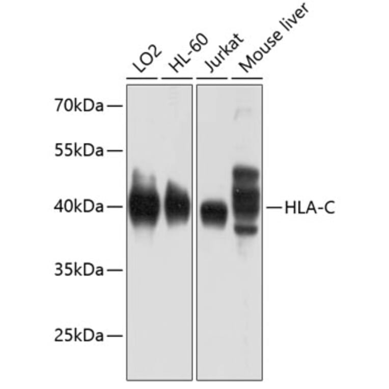 Western Blot - Anti-HLA-C Antibody (A11247) - Antibodies.com