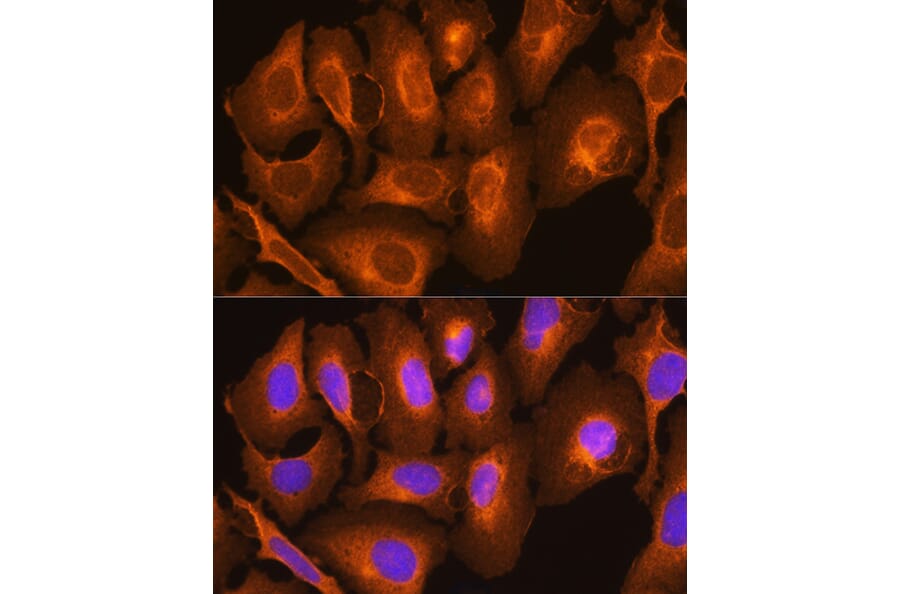 Immunofluorescence - Anti-HLA-C Antibody (A11247) - Antibodies.com
