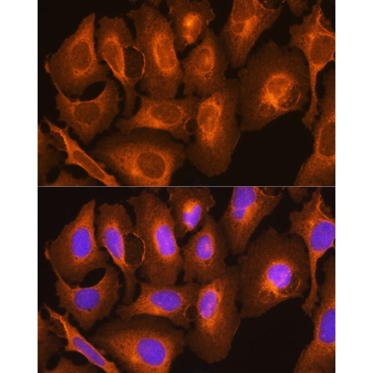 Immunofluorescence - Anti-HLA-C Antibody (A11247) - Antibodies.com