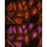 Immunofluorescence - Anti-HLA-C Antibody (A11247) - Antibodies.com