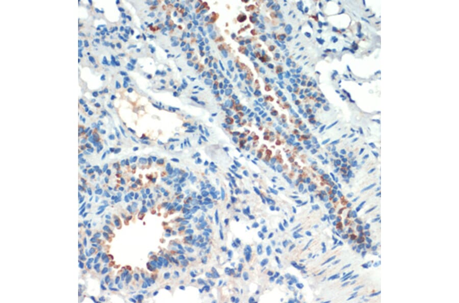 Immunohistochemistry - Anti-MSK2/RSK-B Antibody (A11248) - Antibodies.com