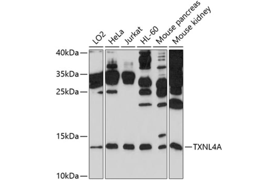 Western Blot - Anti-TXNL4A Antibody (A11249) - Antibodies.com
