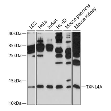 Western Blot - Anti-TXNL4A Antibody (A11249) - Antibodies.com