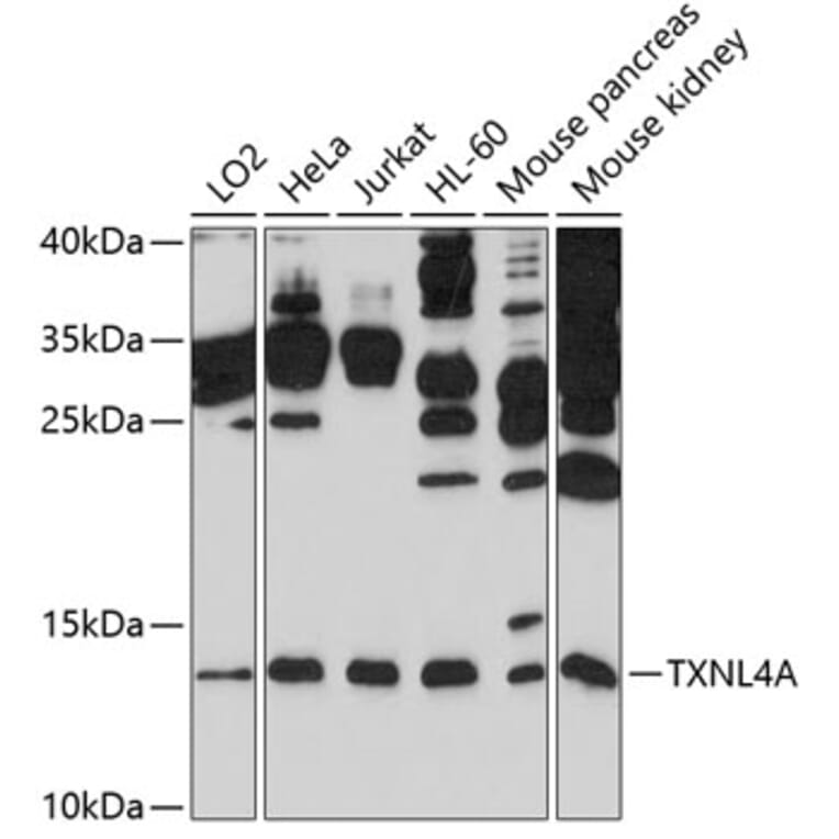 Western Blot - Anti-TXNL4A Antibody (A11249) - Antibodies.com