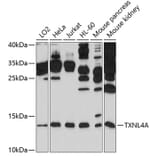 Western Blot - Anti-TXNL4A Antibody (A11249) - Antibodies.com
