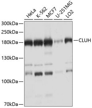 Western blot analysis of extracts of various cell lines, using Anti-CLUH Antibody (A10140) at 1:1,000 dilution.
Secondary antibody: Goat Anti-Rabbit IgG (H+L) (HRP) (AS014) at 1:10,000 dilution.
Lysates / proteins: 25µg per lane.
Blocking buffer: 3% non-fat dry milk in TBST.
Detection: ECL Basic Kit (RM00020).
Exposure time: 15s.