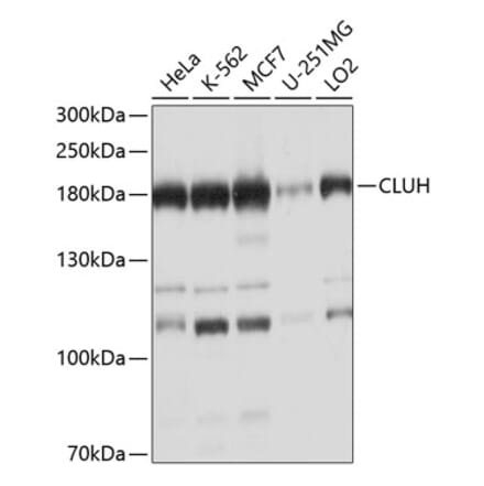 Western Blot - Anti-CLUH Antibody (A11250) - Antibodies.com