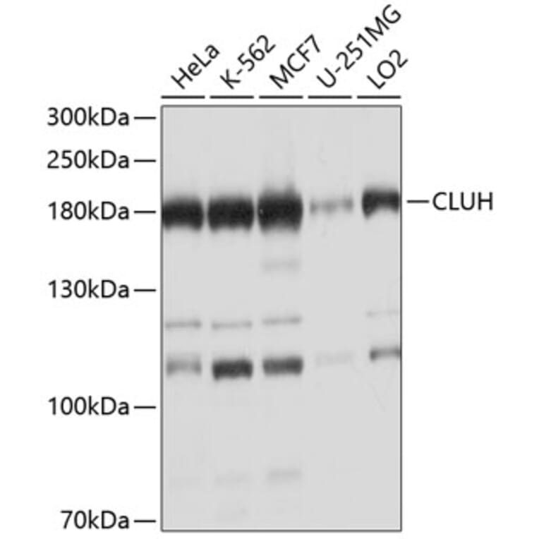 Western Blot - Anti-CLUH Antibody (A11250) - Antibodies.com