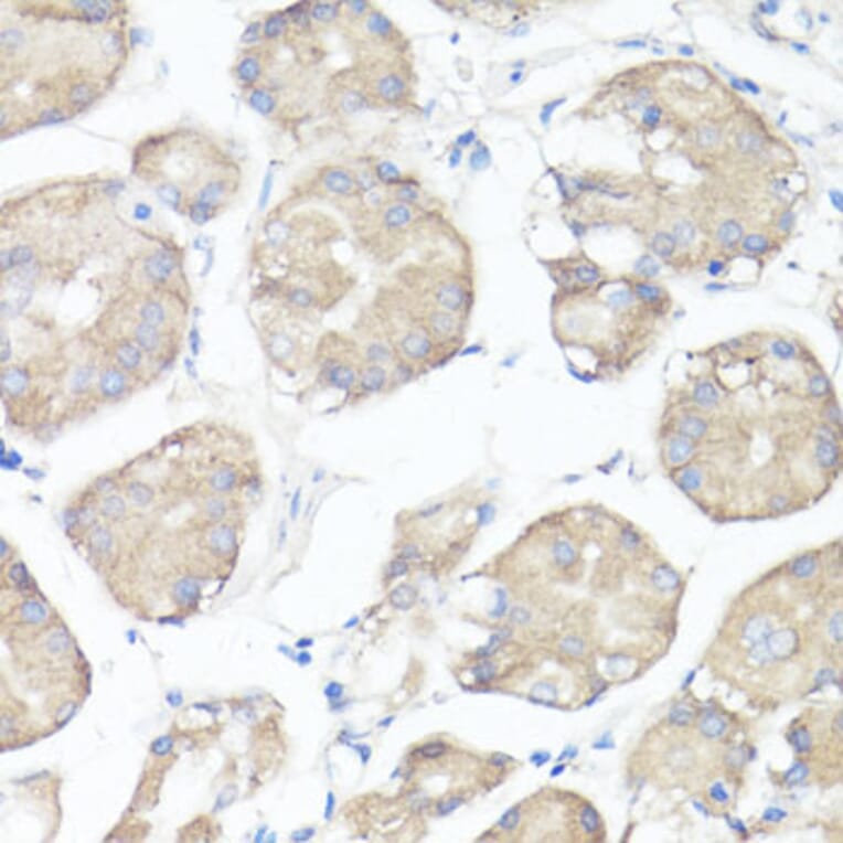Immunohistochemistry - Anti-CLUH Antibody (A11250) - Antibodies.com