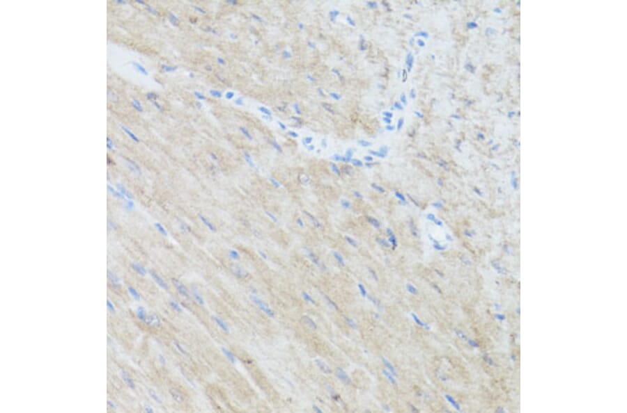 Immunohistochemistry - Anti-CLUH Antibody (A11250) - Antibodies.com